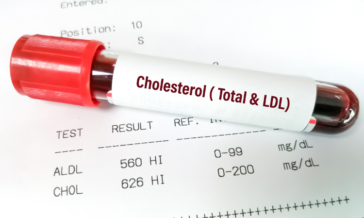 vegetarian-42kg-high-cholesterol