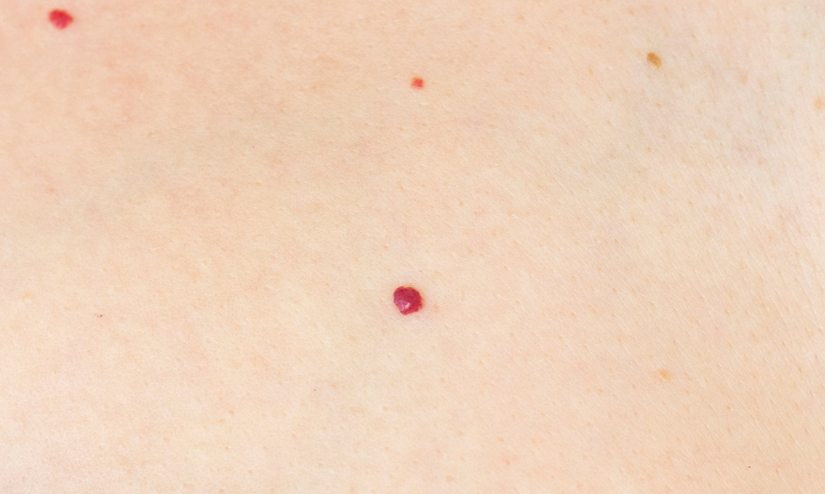 skin-red-dots-reason-symptoms