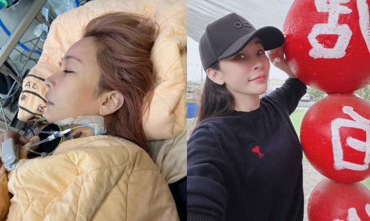 landy-Taiwanese-singer-show-face-after-recovered