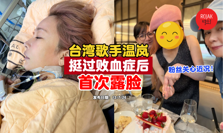 landy-Taiwanese-singer-show-face-after-recovered