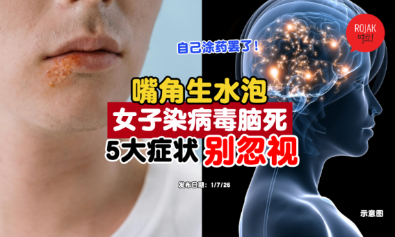 ulcer-hsv-symptoms