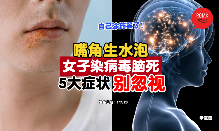 ulcer-hsv-symptoms