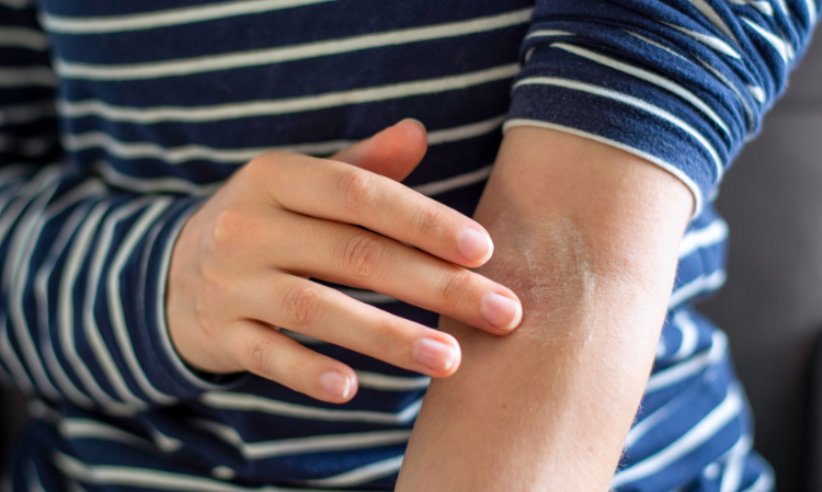 Things-to-Keep-in-Mine-When-Applying-Ointment-