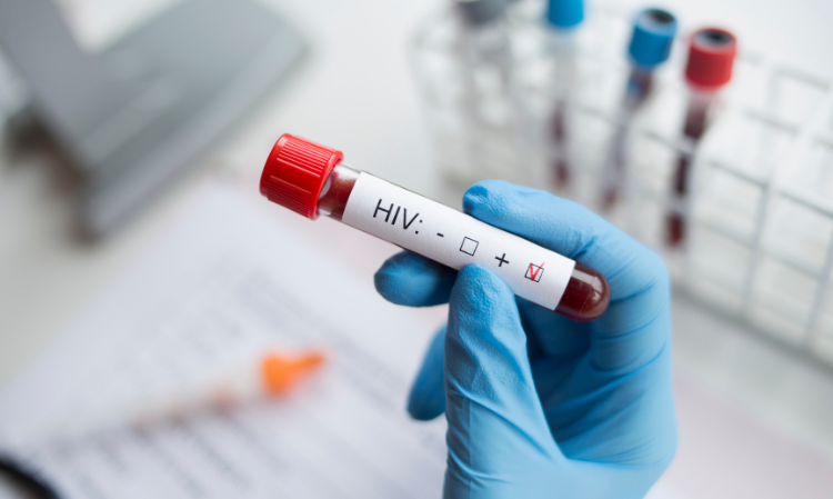 HIV-Fiji-Declares-Stat-of-Emergency-