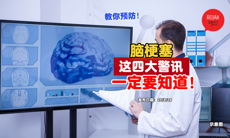 the-symptoms-of-stroke