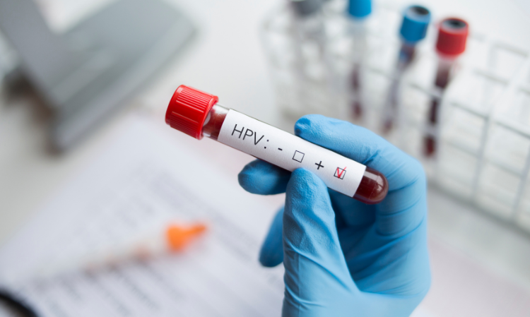 kena-hpv-after-visiting-hot-spring-