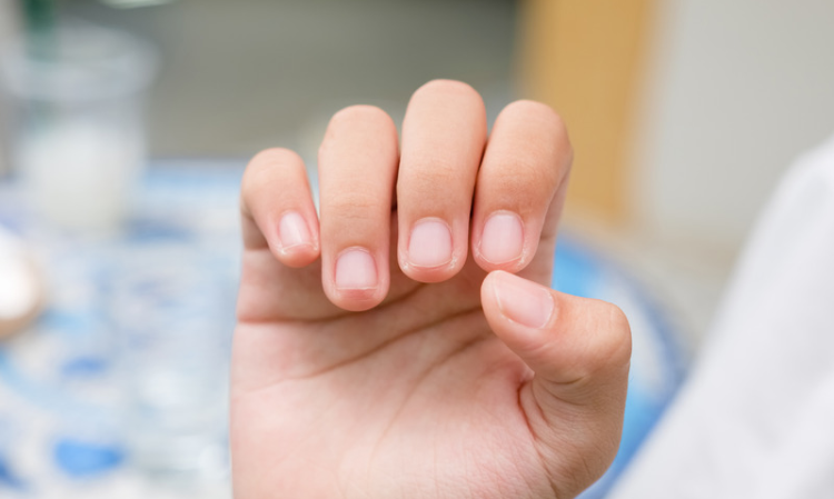 nails-unusual-condition-End-Stage-Renal-Disease