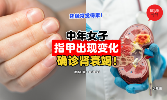nails-unusual-condition-End-Stage-Renal-Disease-