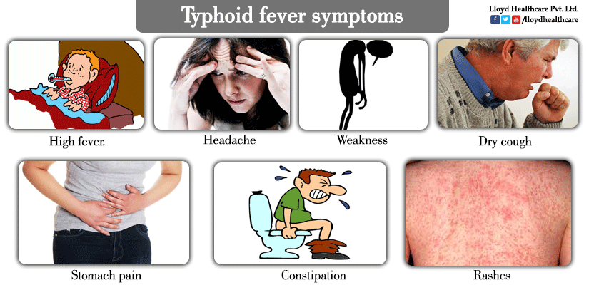 Typhoid-fever-symptoms.